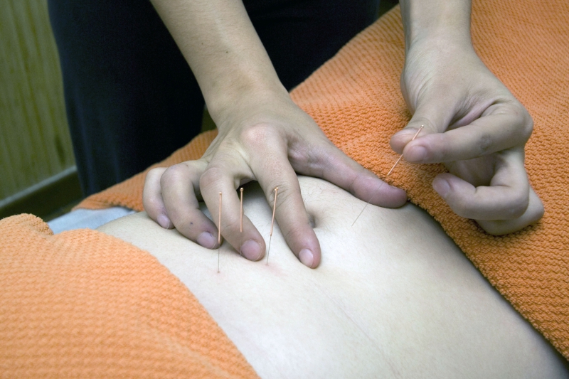 osteopathe-FORCALQUEIRET-min_acupuncture-4175625